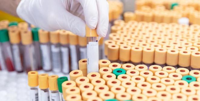 死亡率高达70％美国出现新病毒传染性极高或威胁全人类(图11)